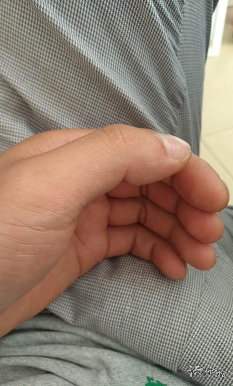 左手大拇指在不规律的抖动